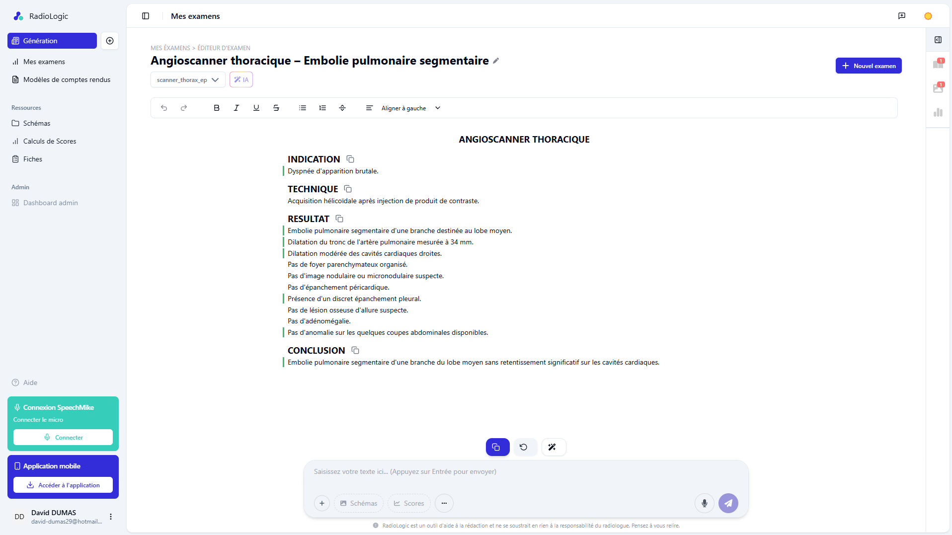 Génération de comptes rendus